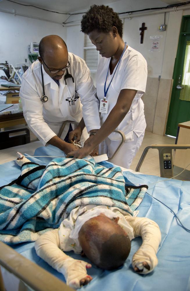 A boy being treated for severe burns in Hospital Sacre Coeur in Milot, Haiti. The boy was carrying a plastic container of diesel fuel and dropped it near a trash fire and it ignited. His parents never came, and the boy died 3 days later.